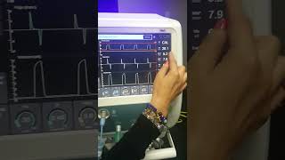 SLE6000 VENTILATOR OPERATION