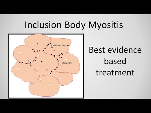 Video: De Bijgewerkte Retrospectieve Vragenlijststudie Van Myositis Sporadische Inclusie In Japan