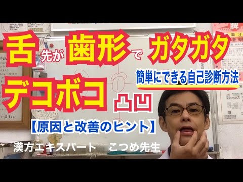 舌のふちにデコボコの歯型がつく低位舌【簡単自己診断方法】