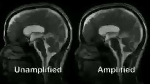 Brain in Motion