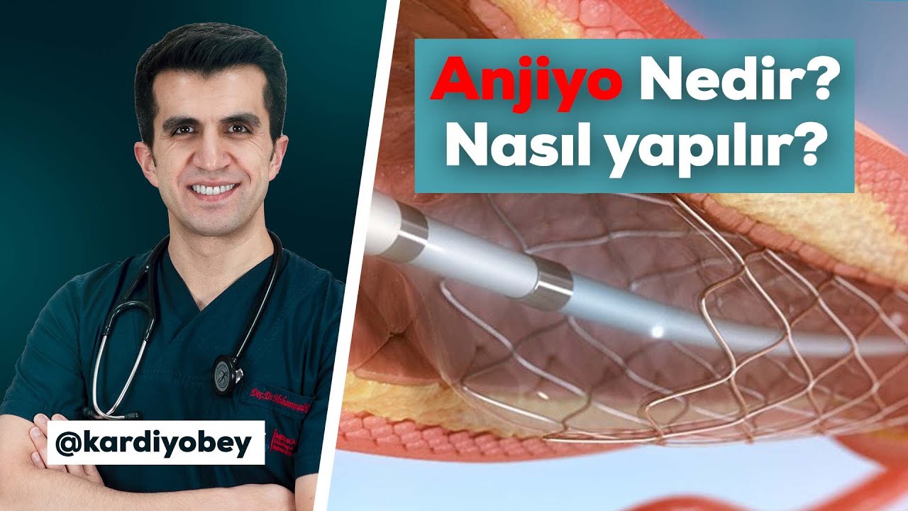 Anjiyo Nedir? Anjiyo Nasıl Yapılır?