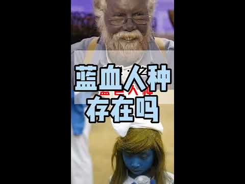 【生物鉴定】蓝血人种存在吗