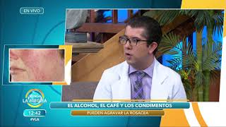 Conoce Los Síntomas De La Rosácea Dermcenter En Venga La Alegría