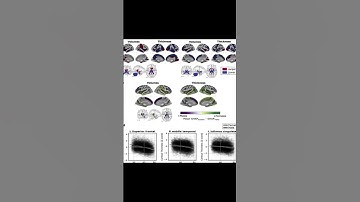 Biological brain age prediction using machine learning on structural neuroimaging dat... | RTCL.TV