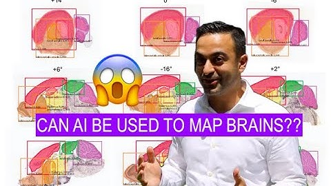 AI for Brain Maps