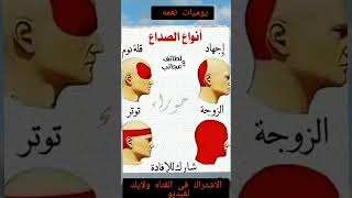 انواع الصداع