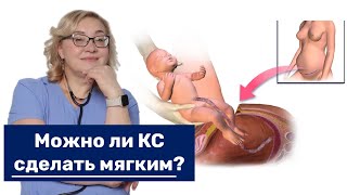 Можно ли кесарево сечение сделать мягким?