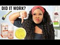 I Tried TOP 5 STRETCH MARKS REMOVAL PRODUCTS | Best Products To Remove Stretch Marks