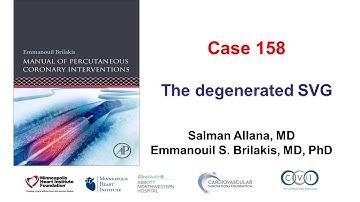 Case 158: Manual of PCI: The degenerated SVG