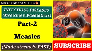 Measles Made Easy Urduhindi
