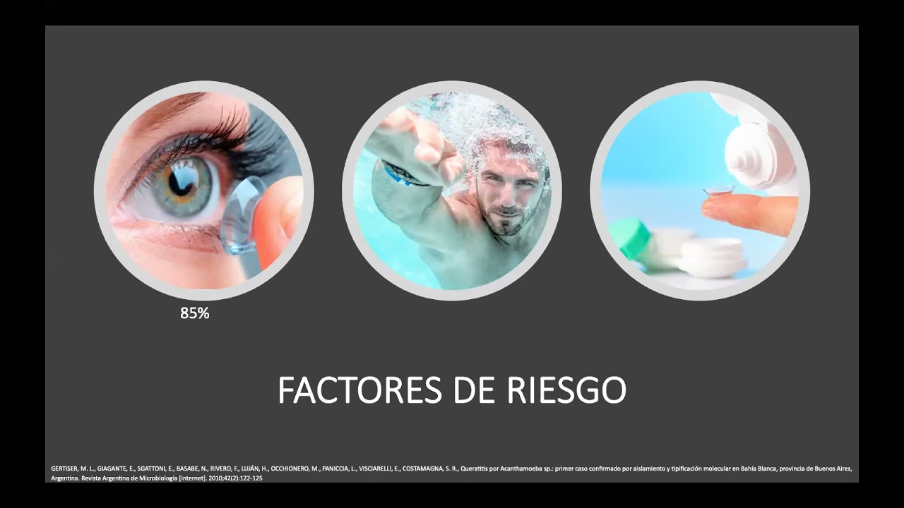 Queratitis parasitarias 1