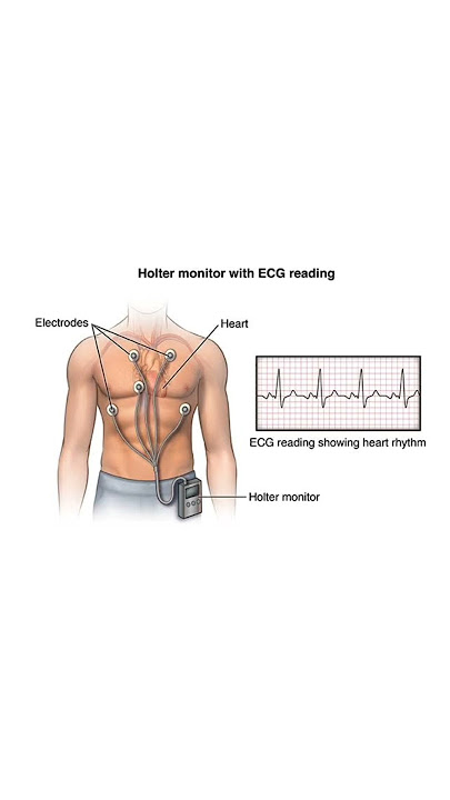 #holter_monitor
