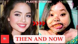 20 Hollywood Stars Who Destroyed Their Looks With Plastic Surgery Regrets | Then and Now 2025
