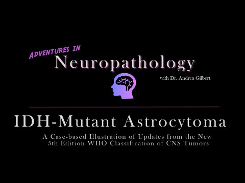 IDH - Mutant Astrocytoma:  Update from the 5th Edition WHO Classification of CNS Tumors
