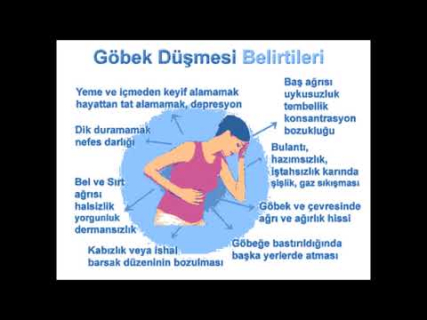 Göbek Düşmesi Belirtileri Nedenleri Tedavisi Nasıl Geçer Anlaşılır