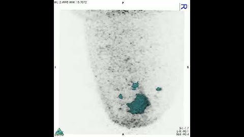 High spatial resolution