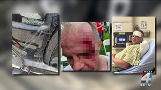 Orlando bicyclist recovering after getting hit by truck during IRONMAN Jacksonville Profile