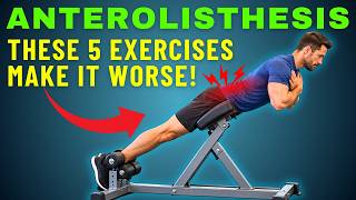 DON’T Do These Back Exercises If You Have L4 or L5 Anterolisthesis