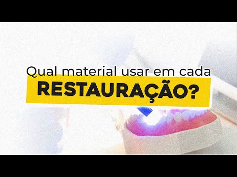 Vídeo: Restauração - o que é? Tipos de restauração