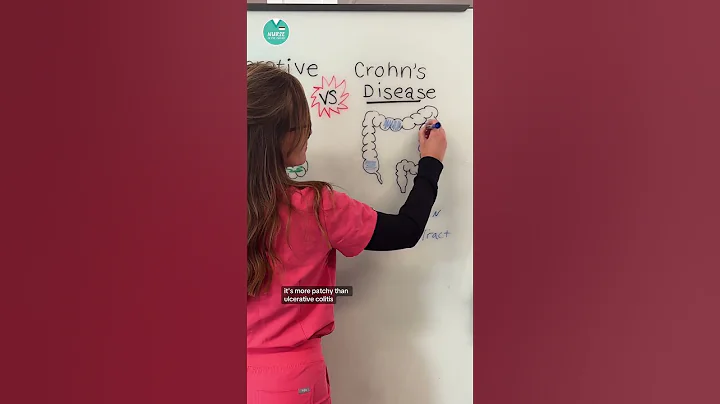 Ulcerative Colitis vs. Crohn’s Disease #RN #BSN #futurenurse