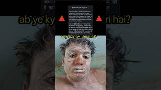 emergency alert message on phone