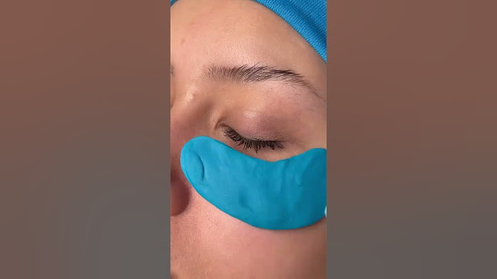 Update my wife's acne #skincare #update #girlfriend #acneskincare #beauty