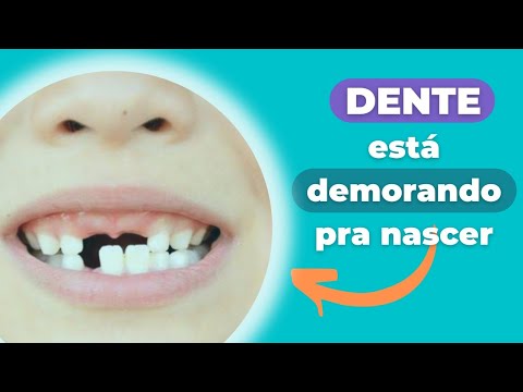 O DENTE ESTÁ