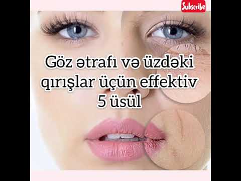 GÖZ ƏTRAFI VƏ ÜZDƏKİ QIRIŞLAR ÜÇÜN EFFEKTİV 5 ÜSÜL .QIRIŞLARA SON !!!