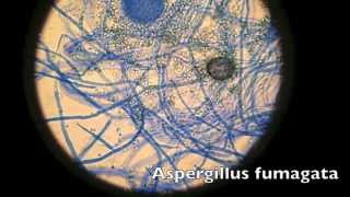 Smartphone Microscopic Photography - The Morrison Technique: Free Hand, No Adapter