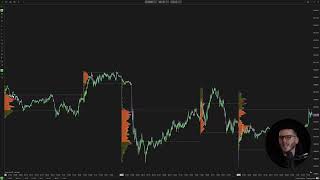 5  Volumetric Trend