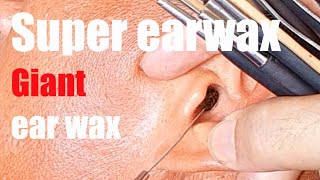 Super ear wax | Ear wax removal satisfying with barber Vietnam