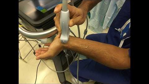 Median nerve scanning at wrist