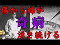 【綿ふき病】人体から植物が生える病