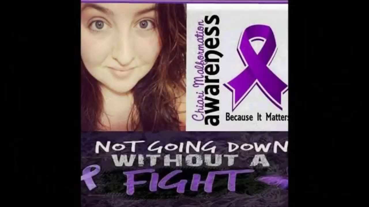 Chiari Malformation: The Many Faces Of Chiari