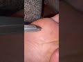 毛を抜くのだ