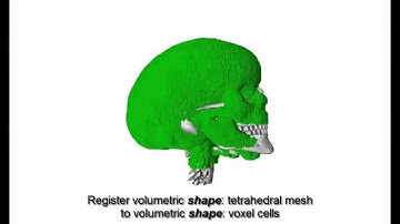 Medical Image Analysis paper: Skuller