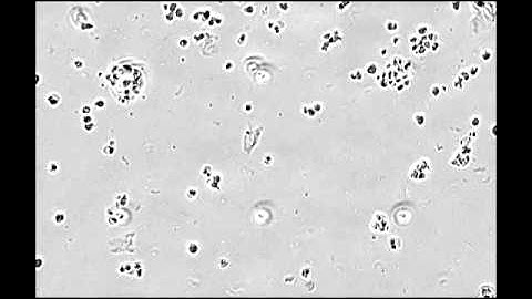 Chemotactic migration of T-cells by live-cell imaging