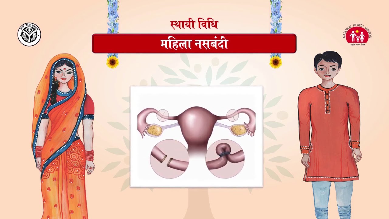 Female Sterilization