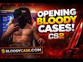 პირველი სპონსორი არხზე CSGO CASE OPENING  #1