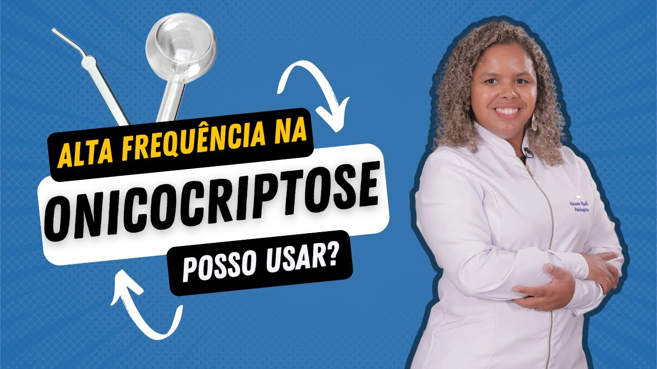 ALTA FREQUÊNCIA NA ONICOCRIPTOSE?