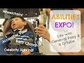 ABILITIES EXPO: Wheelchair Vans, Cerebral Palsy, Feeding Tube, Blenderized Diet,  Micah Fowler