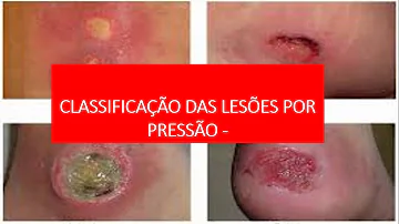 O que é uma lesão como podem ser classificadas as lesões?