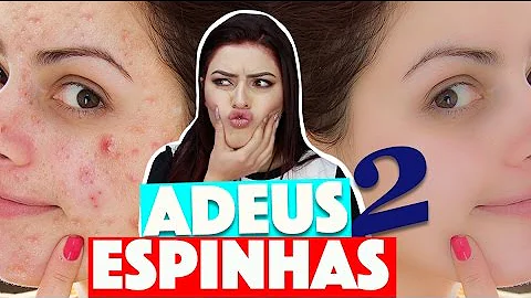 Como secar espinhas em uma noite?
