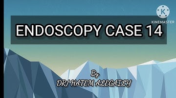 ENDOSCOPY CASE 14 https://youtube.com/@medicalsnacks1526?si=zW8jTNqJrZ6W3odh