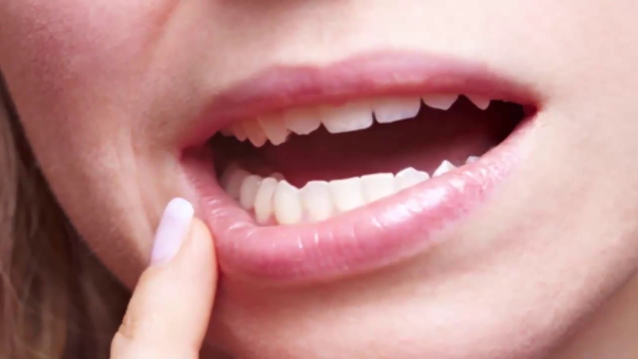 Phaty or Kale Honton Ko Gulabi Karne Ke 3 Nuskhe Beauty Tips For Pink