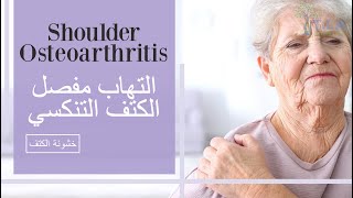 تنكس او خشونة مفصل الكتف  shoulder osteoarthritis