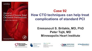 Case 92: Manual of CTO interventions: CTO techniques for complications of non-CTO PCI
