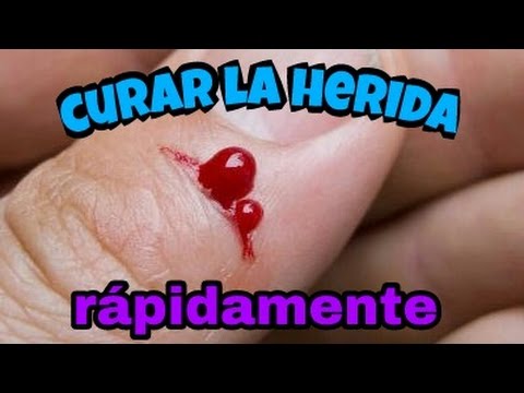 como hacer cicatrizar una herida rapidamente