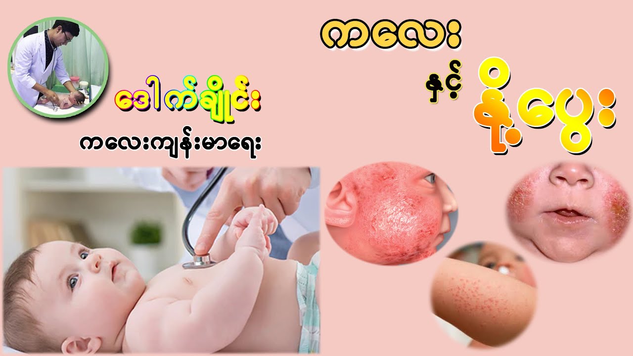 ကလေးနှင့် နို့ပွေး