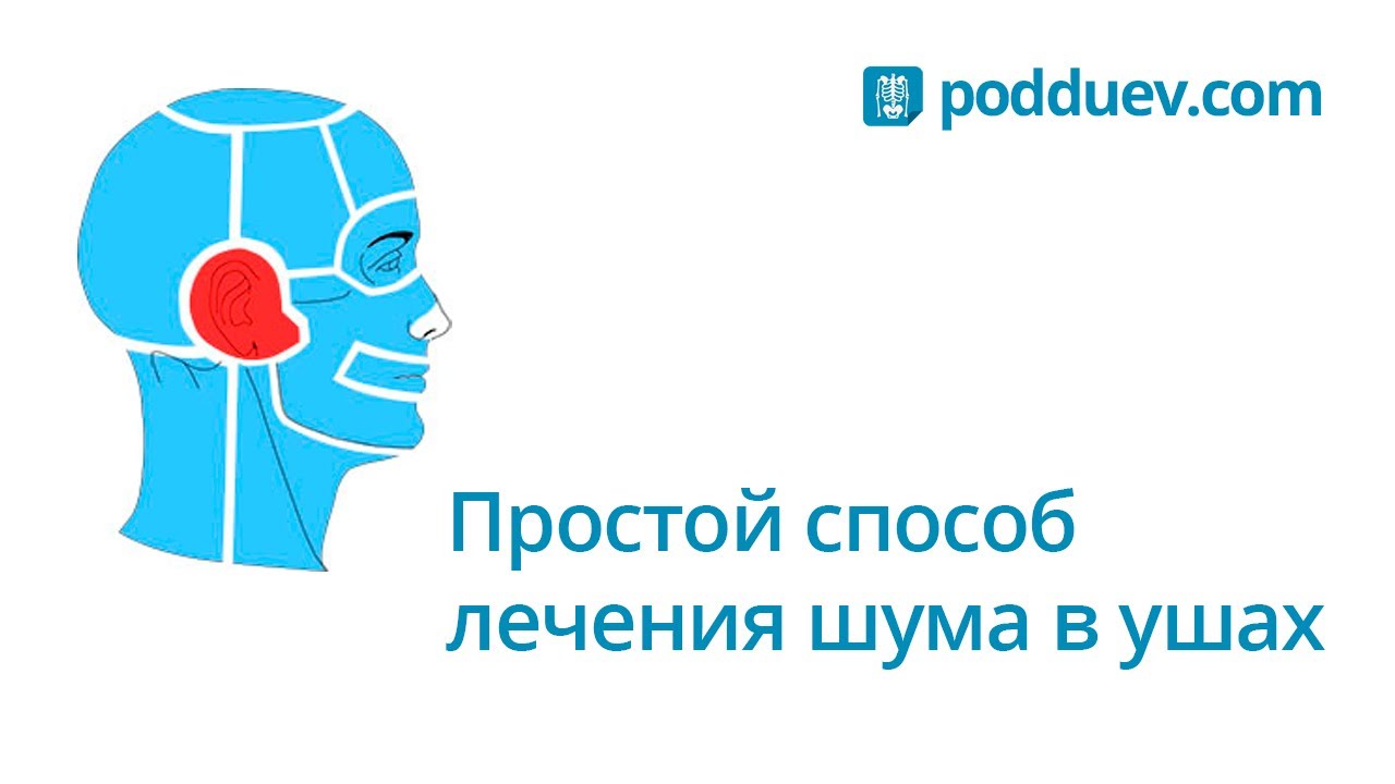 Что пить от шума в голове. Занятия при шуме в ушах. Гимнастика от шума в голове. От шума в ушах. Упражнения при шуме в голове.